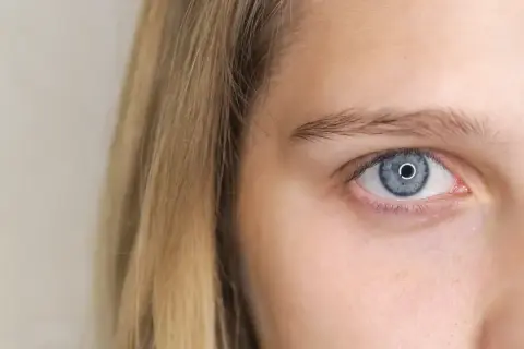 Zbliżenie na niebieskie oko z refleksami, obok blond włosy. Jedno oko mniejsze, ale równie hipnotyzujące.