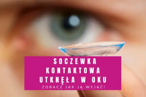 Soczewka kontaktowa utknęła w oku. Zobacz, jak ją wyjąć, gdy jest uszkodzona.