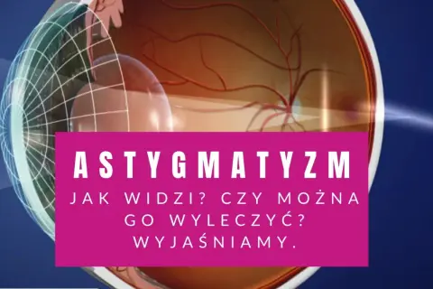 Grafika przedstawia przekrój oka, wyjaśniając problem astygmatyzmu skośnego.
