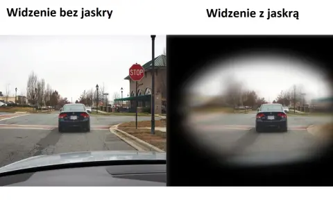 Widzenie z jaskrą jest jak patrzenie przez mglisty tunel, gdzie centrum jest rozmazane, a krawędzie ciemne.
