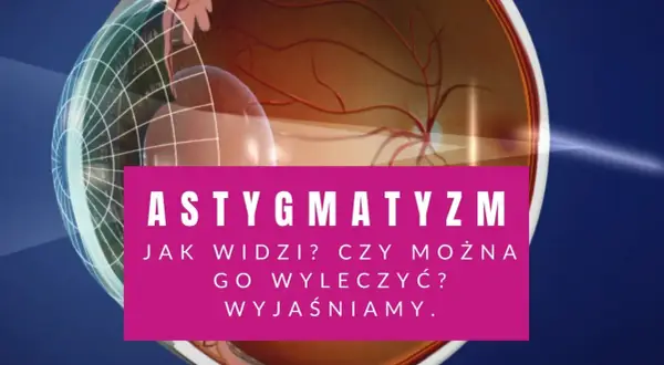 Grafika przedstawia przekrój oka, wyjaśniając problem astygmatyzmu skośnego.