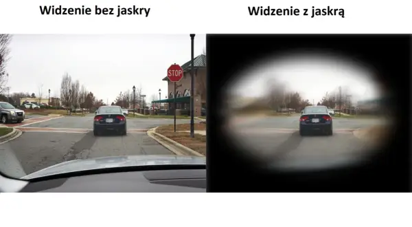 Widzenie z jaskrą jest jak patrzenie przez mglisty tunel, gdzie centrum jest rozmazane, a krawędzie ciemne.