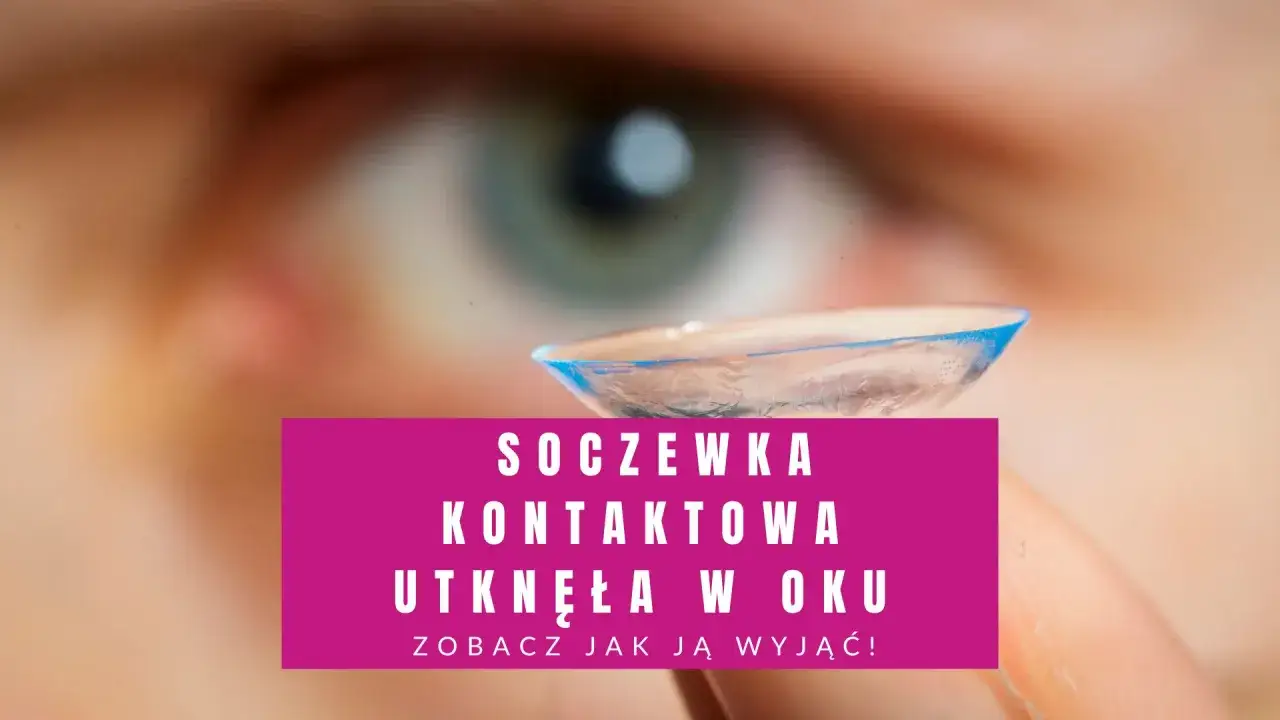 Soczewka kontaktowa utknęła w oku. Zobacz, jak ją wyjąć, gdy coś poszło nie tak.