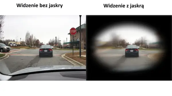 Widzenie z jaskrą jest jak patrzenie przez mglisty tunel, gdzie centrum jest rozmazane, a krawędzie ciemne.